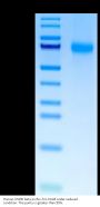 Human OSMR beta Protein (OSM-HM20D)