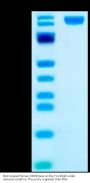 Biotinylated Human OSMR beta Protein (OSM-HM401B)