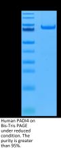 Human PADI4 Protein (PAD-HE104)