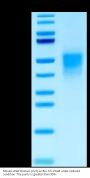 Mouse uPAR/PLAUR Domain (2+3) Protein (PAR-MM1D2)