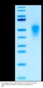 Biotinylated Mouse uPAR/PLAUR Domain (2+3) Protein (PAR-MM1D2B)