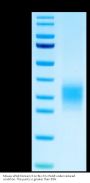 Mouse uPAR/PLAUR Domain 3 Protein (PAR-MM1D3)