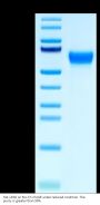 Rat uPAR/PLAUR Protein (PAR-RM401)