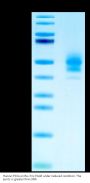 Human PSCA Protein (PCA-HM201)