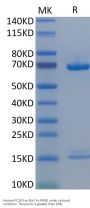 Human PCSK9 Protein (PCS-HM190)