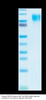 Human PDGF R beta/CD140b Protein (PGF-HM4RB)