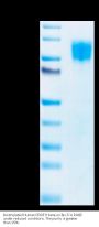 Biotinylated Human PDGF R beta/CD140b Protein (PGF-HM4RBB)