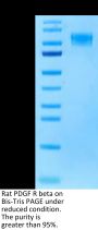 Rat PDGF R beta/CD140b Protein (PGF-RM1RB)