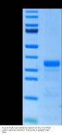 Human PLAU/uPA Protein (active form) (PLA-HM101)