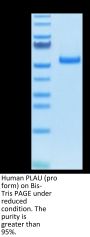 Human PLAU/uPA Protein (pro form) (PLA-HM102)