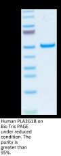 Human PLA2G1B Protein (PLA-HM21B)