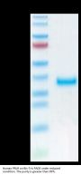 Human PRLR Protein, Ultra Low Endotoxin (PLR-HM101-UL)