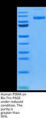 Human PSMA/FOLH1 Protein, Ultra Low Endotoxin (PSM-HM110-UL)