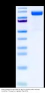Biotinylated Human PSMA/FOLH1 Protein (PSM-HM410B)