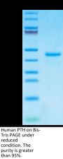 Human PTH Protein (PTH-HM201)