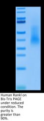 Human RANKL/TNFSF11/CD254 Protein (RKL-HM101)