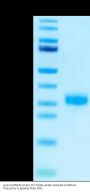 Human RNF43 Protein (RNF-HM143)