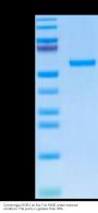 Cynomolgus ROR2/NTRKR2 Protein (ROR-CM102)