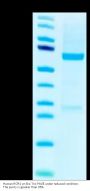 Human ROR1 Protein (ROR-HB101)