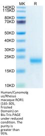 Human/Cynomolgus/Rhesus macaque ROR1 (165-305, Frizzled Domain) Protein (ROR-HM10F)