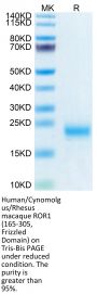 Human/Cynomolgus/Rhesus macaque ROR1 (165-305, Frizzled Domain) Protein (ROR-HM10F)