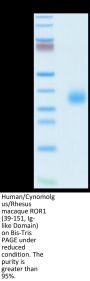 Human/Cynomolgus/Rhesus macaque ROR1 (39-151, Ig-like Domain) Protein (ROR-HM10I)