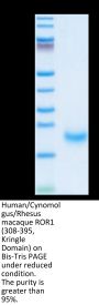 Human/Cynomolgus/Rhesus macaque ROR1 (308-395, Kringle Domain) Protein (ROR-HM10K)