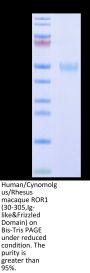Human/Cynomolgus/Rhesus macaque ROR1 (30-305,Ig-like&Frizzled Domain) Protein (ROR-HM1IF)