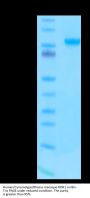 Human/Cynomolgus/Rhesus macaque ROR1 Protein (ROR-HM201)