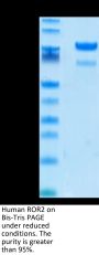 Human ROR2/NTRKR2 Protein (ROR-HM202)