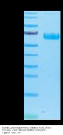 Human/Cynomolgus/Rhesus macaque ROR1 Protein, Ultra Low Endotoxin (ROR-HM401-UL)