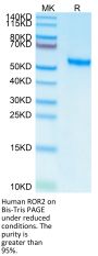 Human ROR2/NTRKR2 Protein (ROR-HM402)