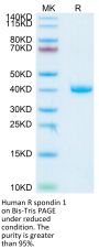 Human R spondin 1/RSPO1 Protein (RS1-HM101)