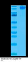 Human Semaphorin 4D/SEMA4D/CD100 Protein (SEM-HM44D)