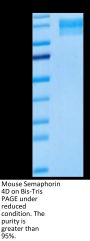 Mouse Semaphorin 4D/SEMA4D/CD100 Protein (SEM-MM14D)