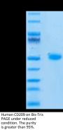 Human CD209/DC-SIGN Protein (SIG-HM101)