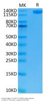 Human Siglec-2/CD22 Protein (SIG-HM222)