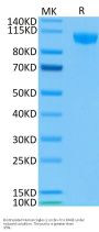 Biotinylated Human Siglec-2/CD22 Protein (SIG-HM412B)