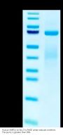 Human SMPD1 Protein (SMD-HB101)