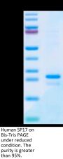 Human SP17 Protein (SP7-HE117)