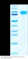 Human SR-BI/SCARB1 Protein (SRI-HM101)