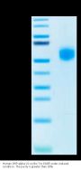 Human SIRP alpha V2/CD172a Protein (SRP-HM1V2)