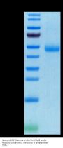 Human SIRP Gamma/CD172g Protein (SRP-HM40G)