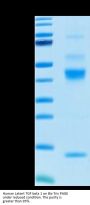 Human Latent TGF beta 1/TGFB1 Protein (TG1-HM401)