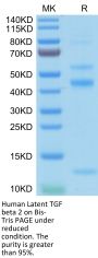 Human Latent TGF beta 2/TGFB2 Protein (TGF-HM102)