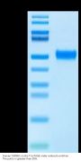 Human TGFBR1 Protein, Ultra Low Endotoxin (TGF-HM6R1-UL)