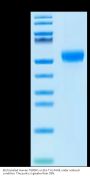 Biotinylated Human TGFBR1 Protein (TGF-HM6R1B)