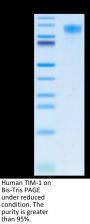 Human TIM-1/HAVCR1 Protein (TIM-HM101)