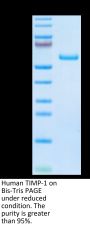 Human TIMP-1 Protein (TIM-HM201)