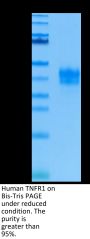 Human TNFR1/CD120a/TNFRSF1A Protein (TNF-HM1R1)